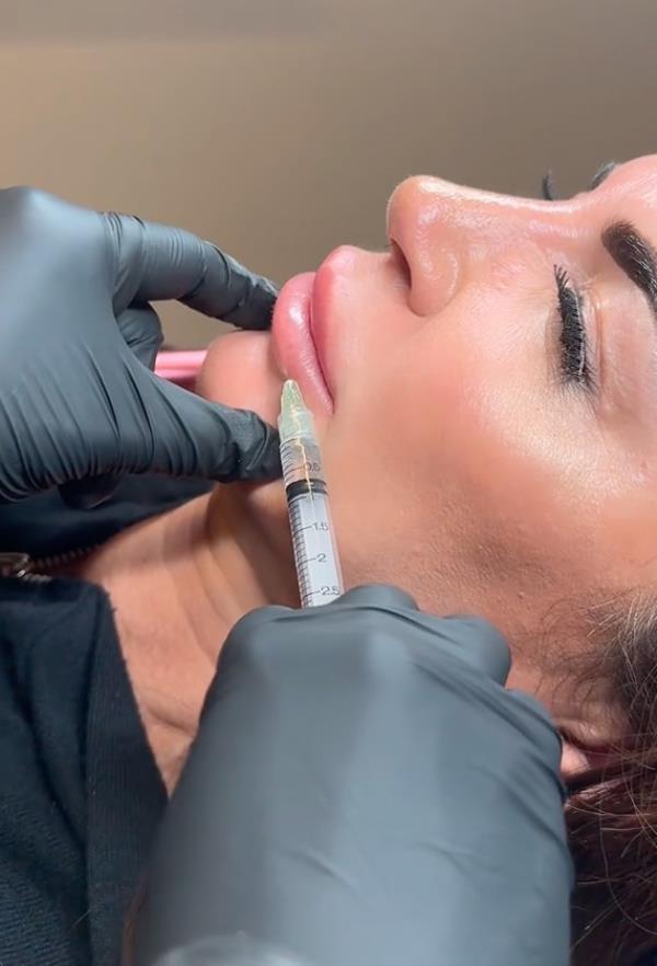 Teresa Giudice undergoing a botox injection to dissolve her lip filler